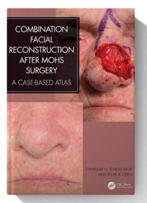 Combination Facial Reconstruction after Mohs Surgery: A Case Based Atlas 1st Edition