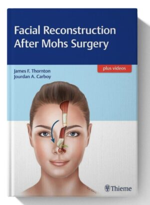 Facial Reconstruction After Mohs Surgery