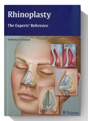 Rhinoplasty: The Experts' Reference 1st Edition, Kindle Edition