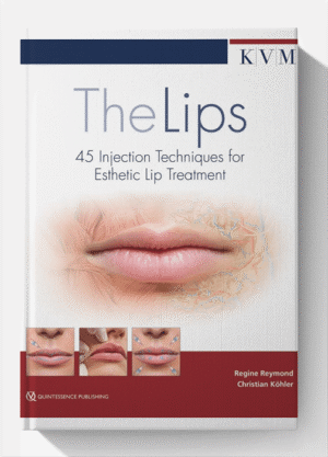 The Lips: 45 Injection Techniques for Esthetic Lip Treatment 1st Edition