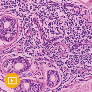 Oakstone Dermatopathology