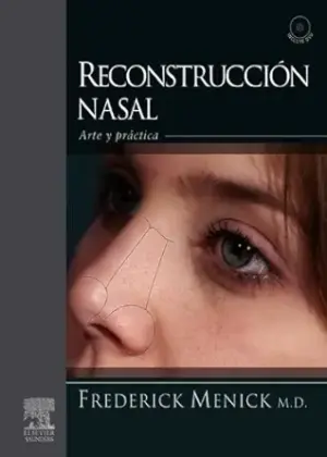 Reconstrucción nasal: Arte y práctica (Spanish Edition) Kindle Edition