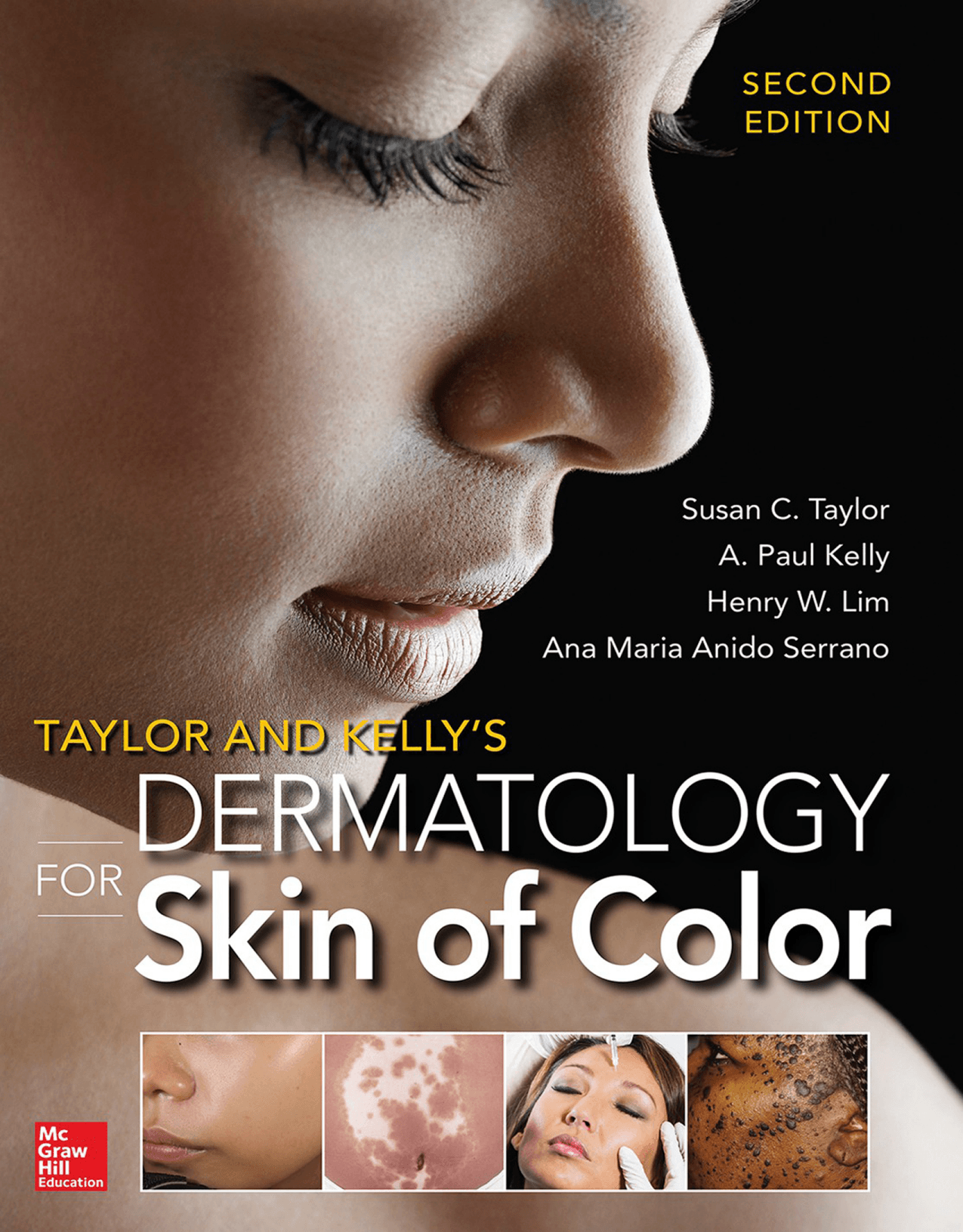 Taylor and Kelly’s Dermatology for Skin of Color 2/E