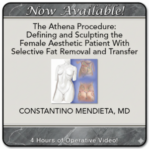 Advanced Female Body Sculpting With Selective Fat Removal and Transfer