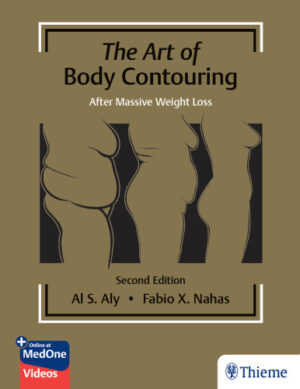 The art of body contouring : body contouring after massive weight loss
